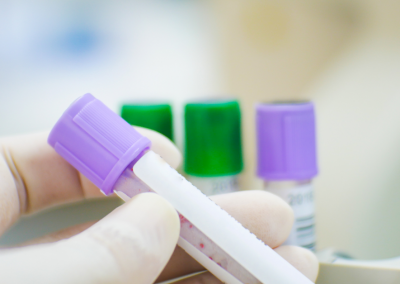 Evaluación de las concentraciones en suero de troponina-l cardíaca para el diagnóstico de endocarditis infecciosa en perros