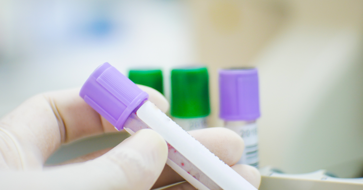 Evaluación de las concentraciones en suero de troponina-l cardíaca para el diagnóstico de endocarditis infecciosa en perros